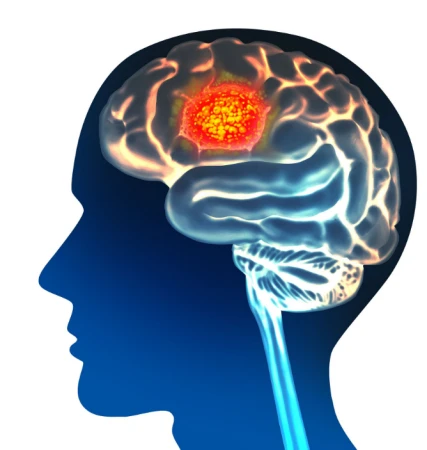 Pramiracetam powder Pramiracetam powder
