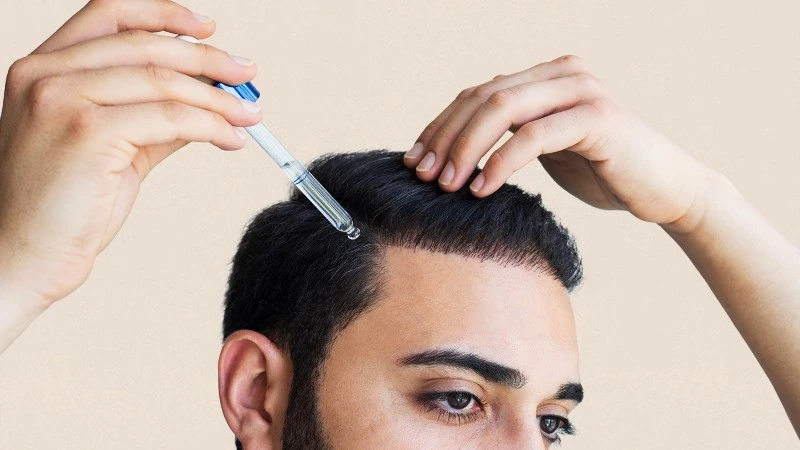 what-are-the-treatment-options-for-androgenetic-alopecia-1440x810 what-are-the-treatment-options-for-androgenetic-alopecia-1440x810