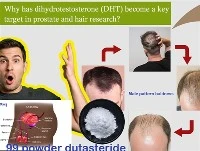 Zakaj je DHT postal ključna tarča v raziskavah prostate in las